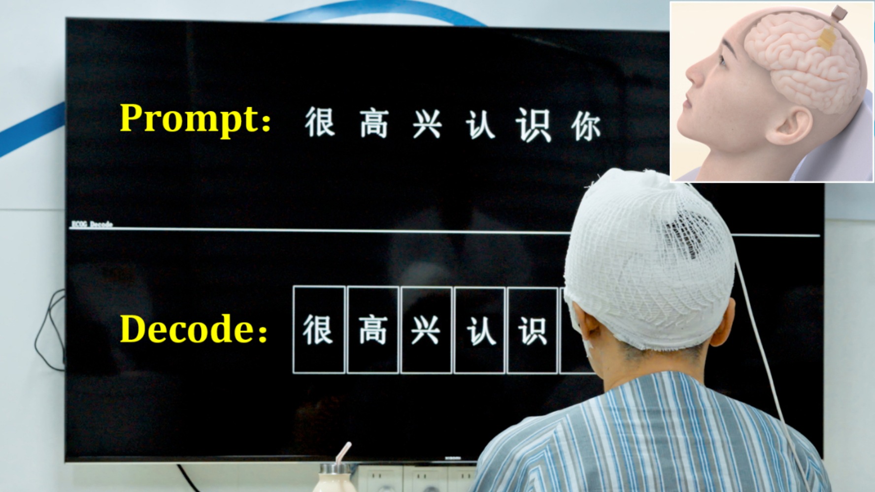 全球首例实时汉语解码和语音合成临床试验
